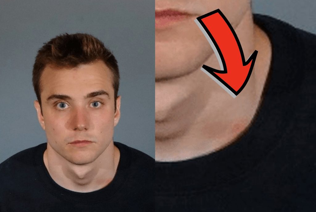 Calum McSwiggan's police mugshot. Zoomed in on Calum's neck on right