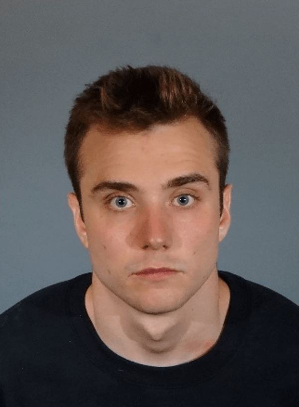 Calum McSwiggan's mugshot from when he was arrested for vandalism - note his face is not injured