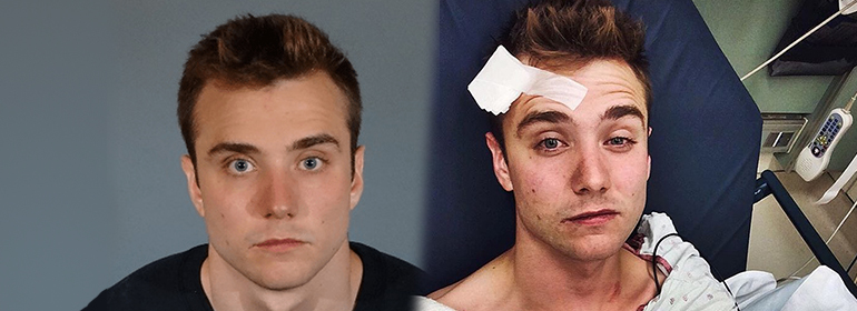 Calum McSwiggan mugshot from being arrested and his selfie after suffering self inflicted injuries in hospital on right