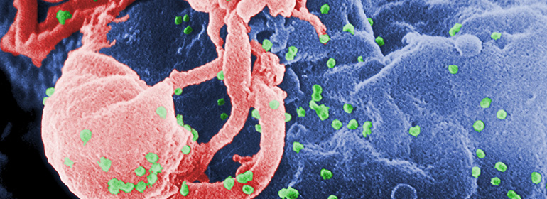 Antiretroviral drugs successfully prevent HIV transmission (HIV virus pictured)