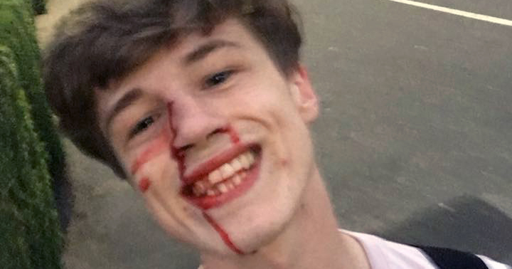 Blair Wilson smiling while taking a selfie after the homophobic attack