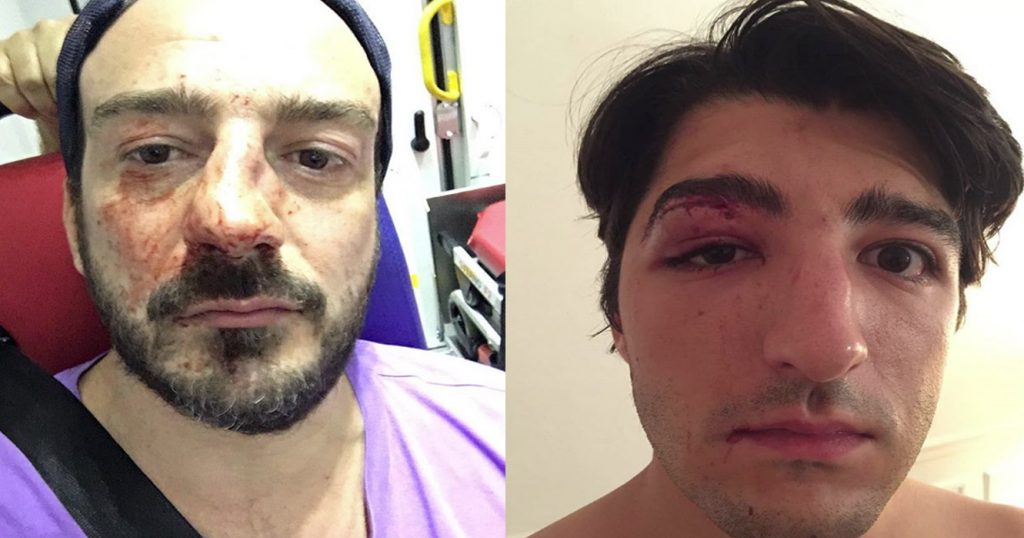 Two gay men attacked in Paris