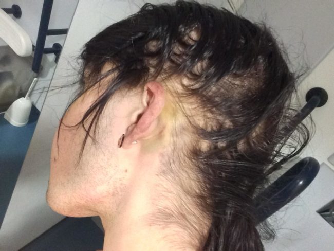 queer teenager who was beaten up in Bristol