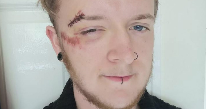 Image of Oscar, who need six stitches after he was assaulted.