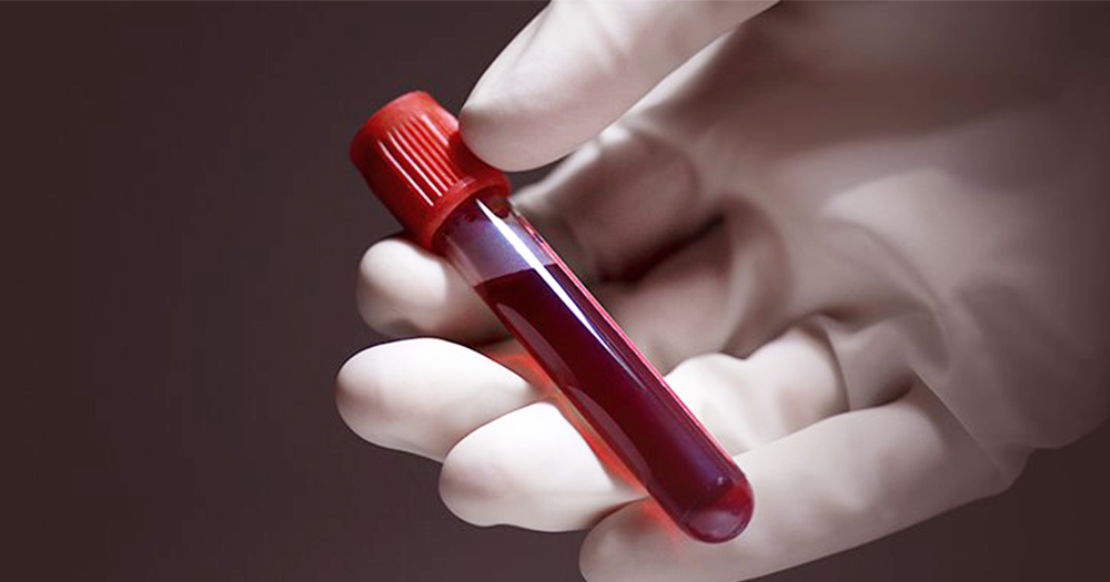 A rubber gloved hand holding a test tube of blood