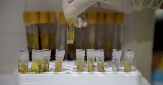 A HIV test used to test a patient in a lab.