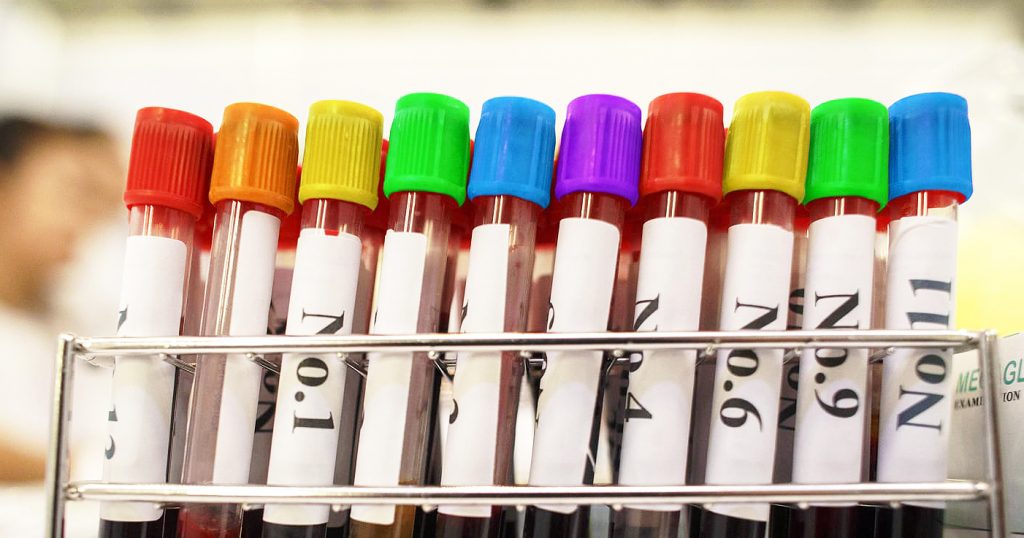 A row of blood filled vials with variously coloured lids