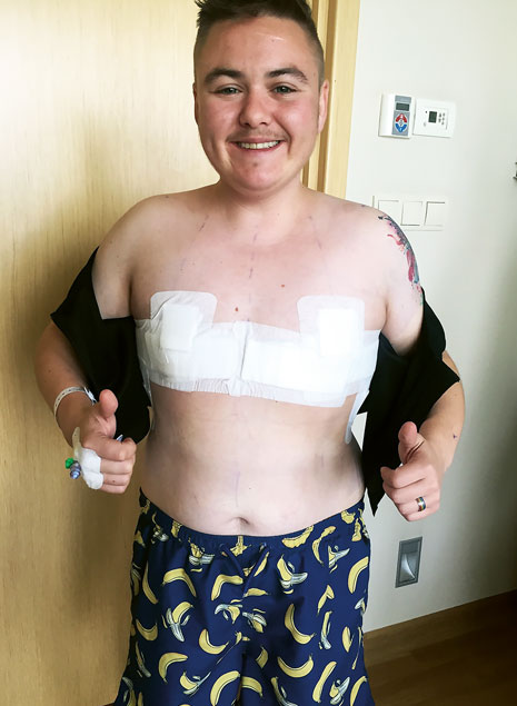 Young trans man smiling, showing the bandages from his top surgery