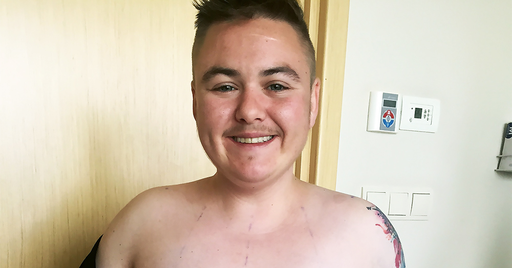 Close-up of young trans man smiling after his top surgery