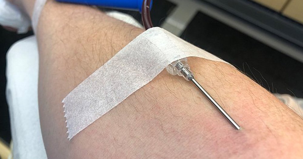 Blood ban to be lifted - close up photograph of a man's arm with a needle inserted into it.