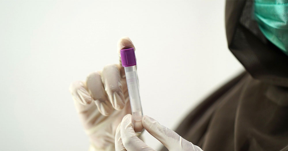 Close up of a medical practitioner's hands holding a test tube with a sample in it. This story explores the medical treatment of Trans teens.