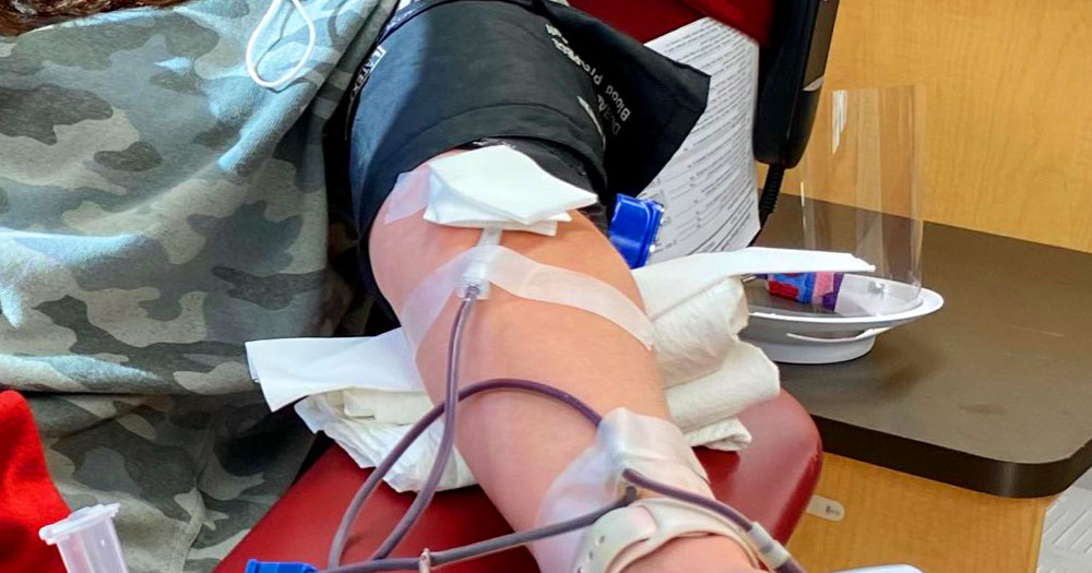 Canadian authorities are to lift a blood ban on GBMSM from donating. The photograph shows an arm with tubes and needles for extracting blood.