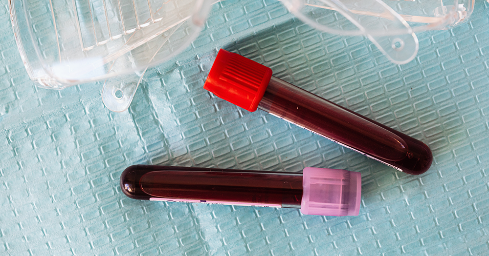 Test tubes of blood on a medical blue cloth.