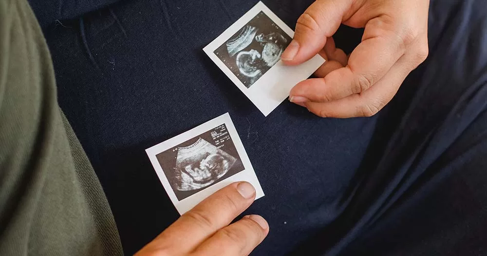 Two hands hold ultrasound photos representing Ireland's new IVF scheme