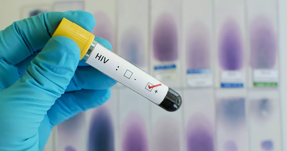A blue, rubber gloved hand holds a test tube indicating a positive HIV diagnoses.