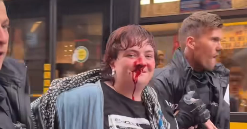 The image shows activist Katy O'Brien with blood on their face from an assault by Berlin Police