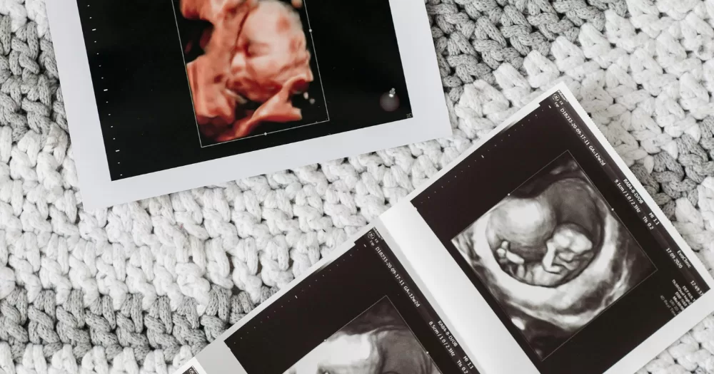 A baby scan - Queer families could soon share DNA with their children after researches create human eggs cells from skin