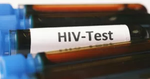 A vial labelled 'HIV-Test'.
