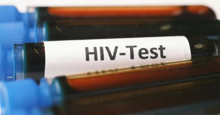 A vial labelled 'HIV-Test'.