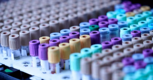 Transgress the NGS partners with Ana Liffey to offer healthcare initiative for trans people in Dublin. Stock image of blood testing vials.